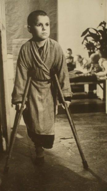 Sepia photograph of a thin young boy in a hospital gown walking on crutches with one leg bandaged.